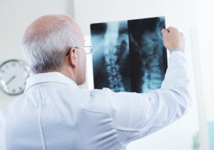 Photo of Doctor examining patient's spinal X-Rays